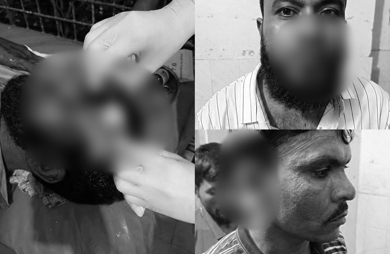 দৌলতপুরে জমি বিরোধে দুই পক্ষের সং/ঘ/র্ষ, ককটেল বি/স্ফো/রণ